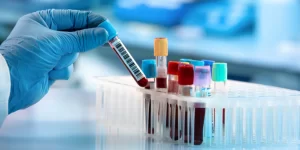 laboratory services for weight loss programs