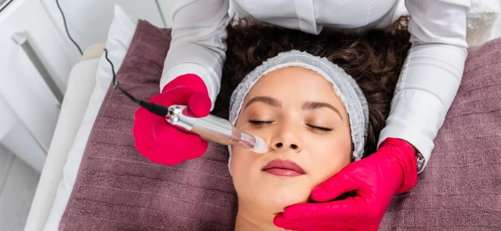 microneedling rejuvenation treatment