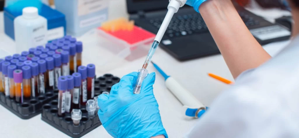 hormone testing mansfield tx levels and wellness guide